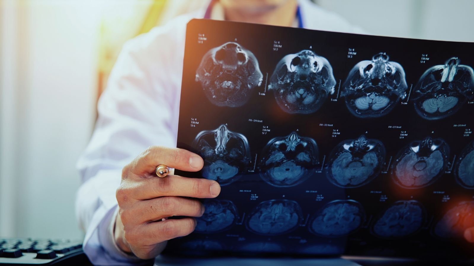 Stroke Aspiration Thrombectomy Trial